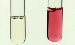 Voges-Proskauer Test